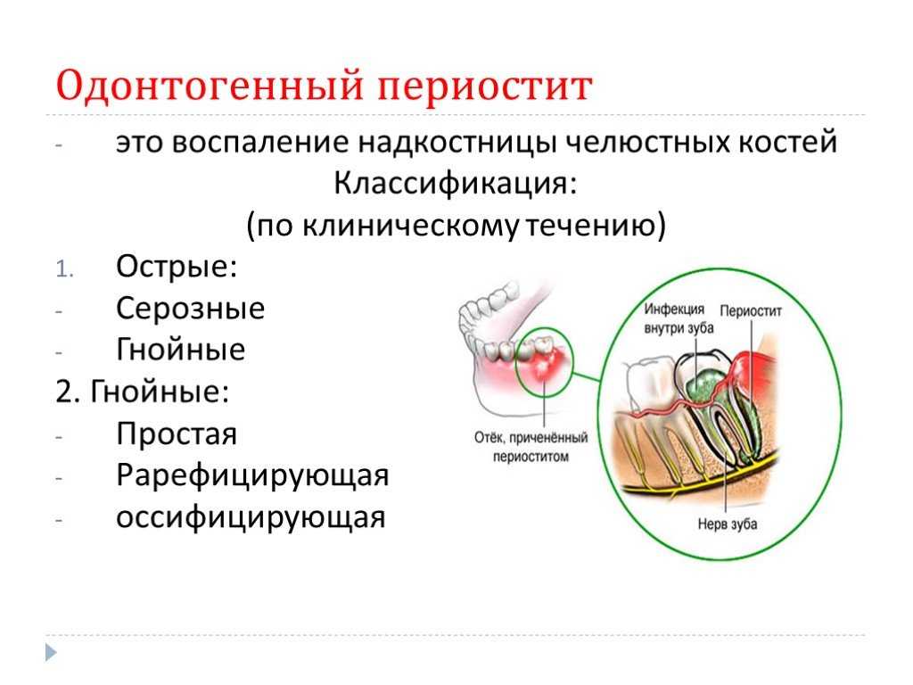 Презентация на тему "опухоли челюстно-лицевой области"