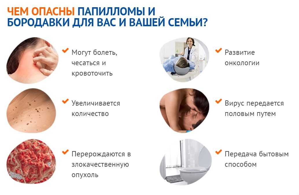 Впч в гинекологии. профилактика вируса папилломы человека