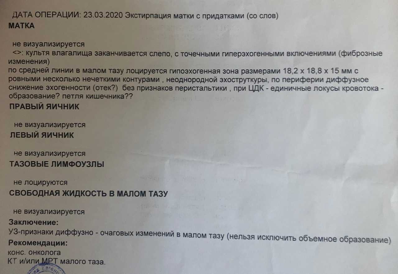 Гистерэктомия - женщины, которым удалили матку - как жить дальше