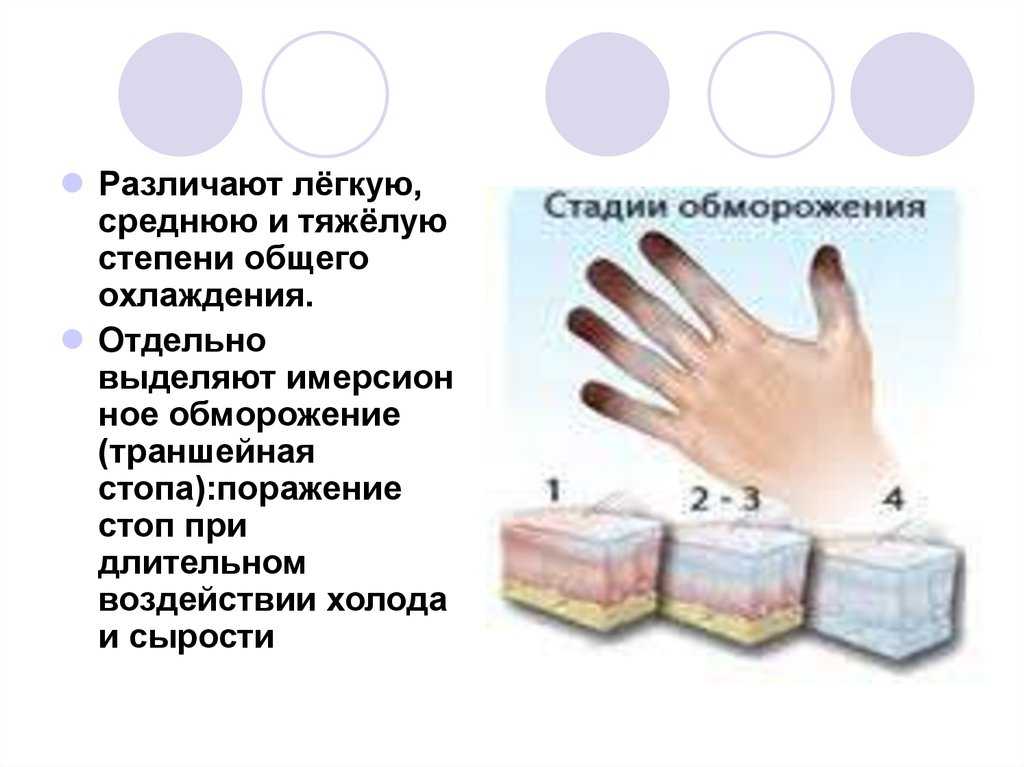 Обморожение ног: первая помощь и лечение