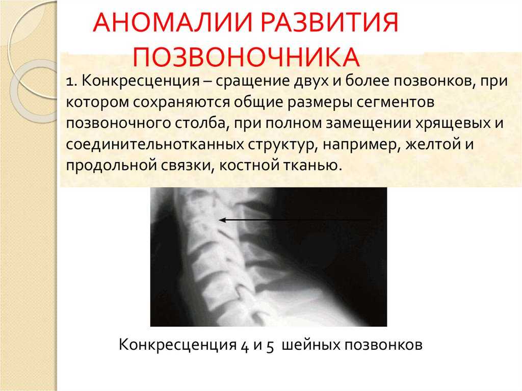 Патологии позвоночника у плода, выявляемые на узи * клиника диана в санкт-петербурге