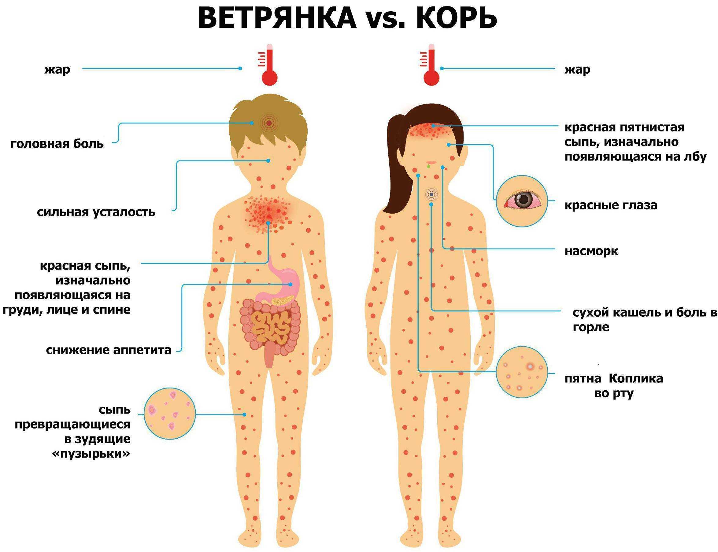 Опоясывающий лишай (герпес) — причины, симптомы, диагностика, лечение лишая в москве