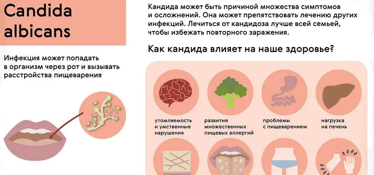 Кандидоз: лечение, препараты