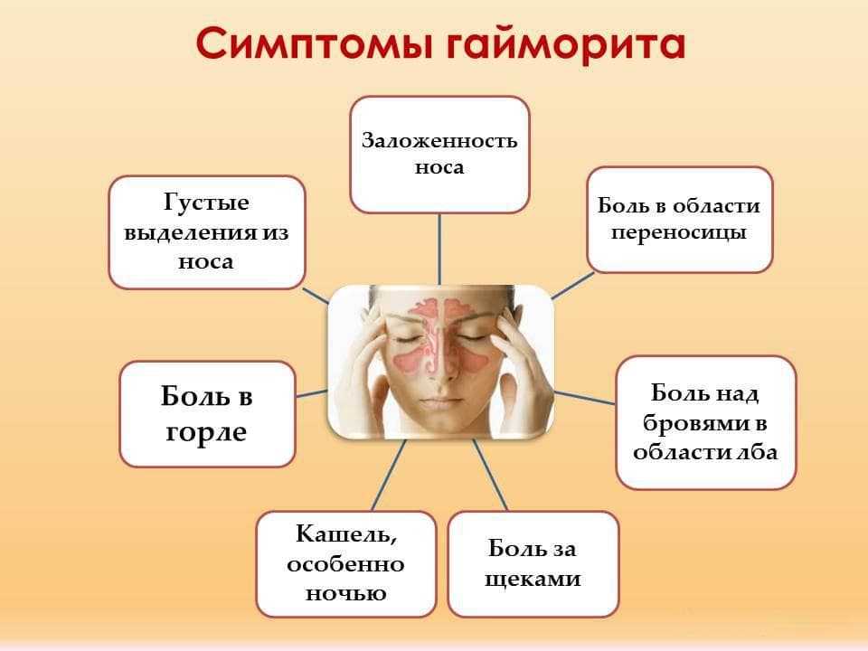 Как определяют гайморит?