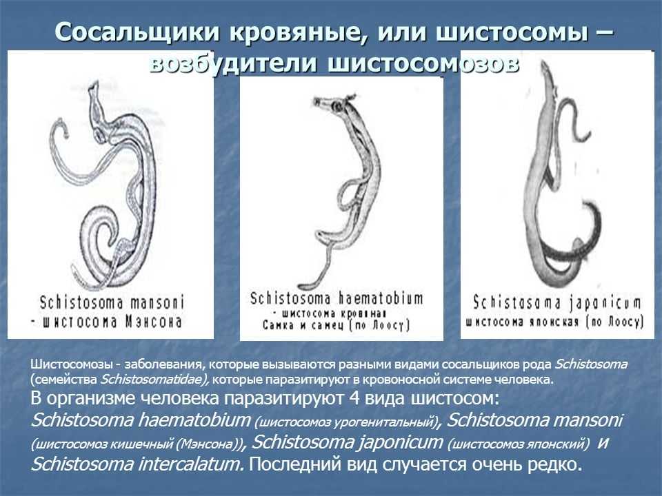 Кишечный шистосомоз мэнсона, лечение, причины, симптомы,  профилактика.