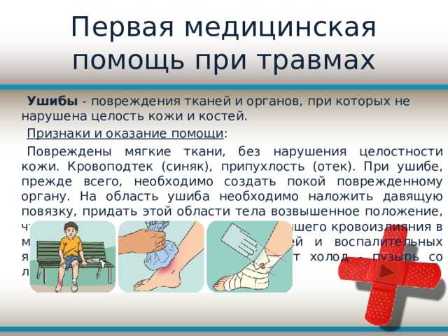 Ушиб кисти руки мкб-10: причины, симптомы, лечение