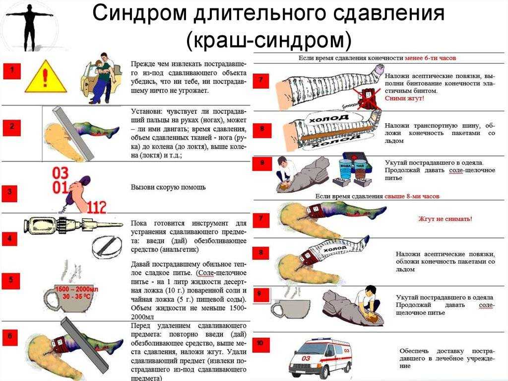 Синдром длительного сдавления: первая помощь при краш-синдроме, его причины и механизм развития