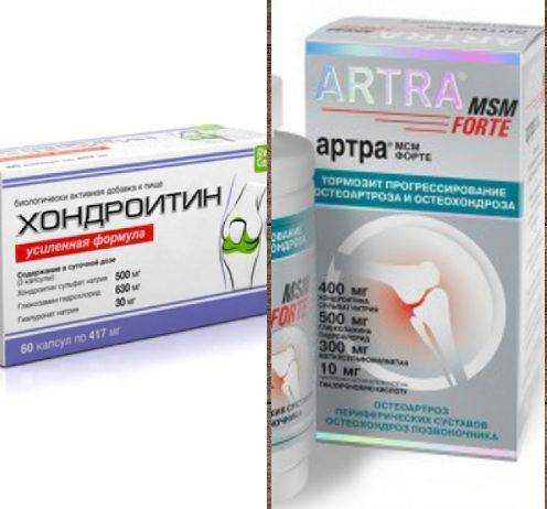 Хондрогард при артрозе плечевого сустава