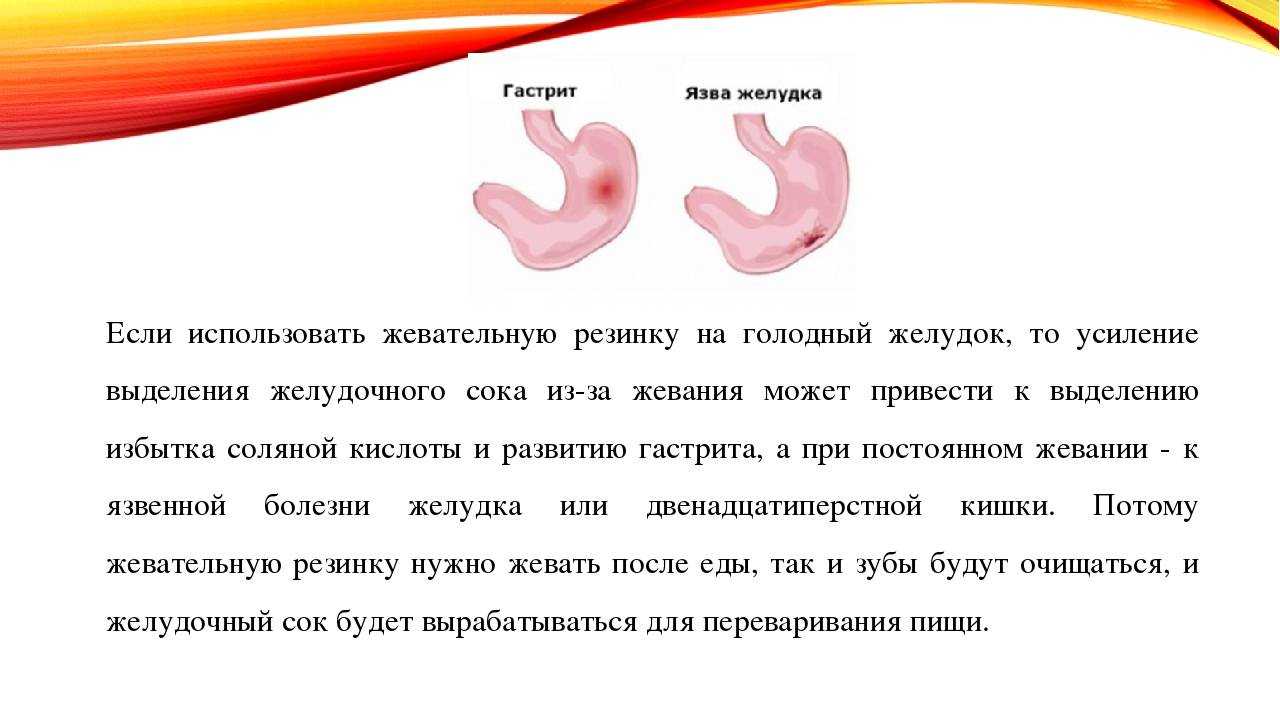 Что будет если постоянно жевать жвачку