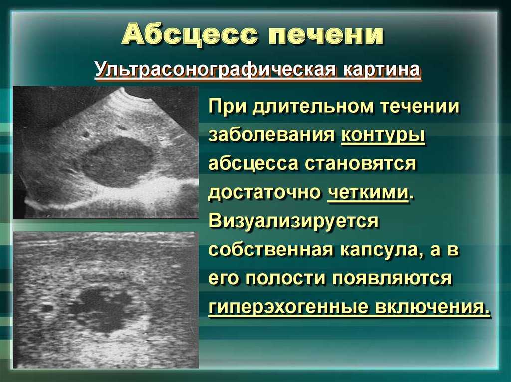 Что такое гнойный абсцесс: признаки абсцедирования, фото и лечение заболевания | pro-zdorov.ru