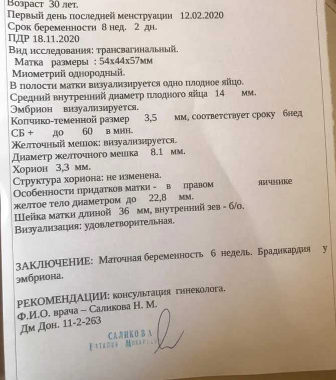 Брадикардия у плода - причины, симптомы, диагностика и лечение