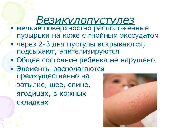 Белые прыщики у новорожденного на лице