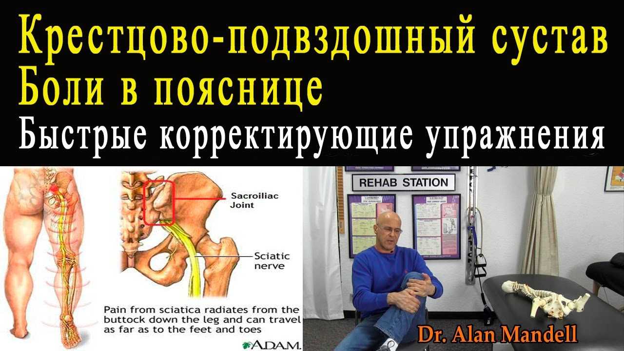 Причины боли в крестце у женщин, их диагностика и лечение