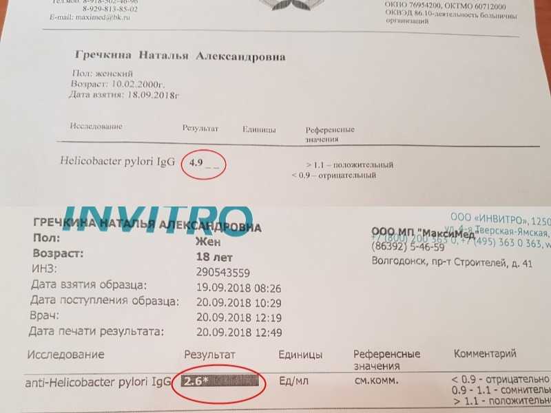 Определение хеликобактер в кале: подготовка, преимущества и недостатки | food and health