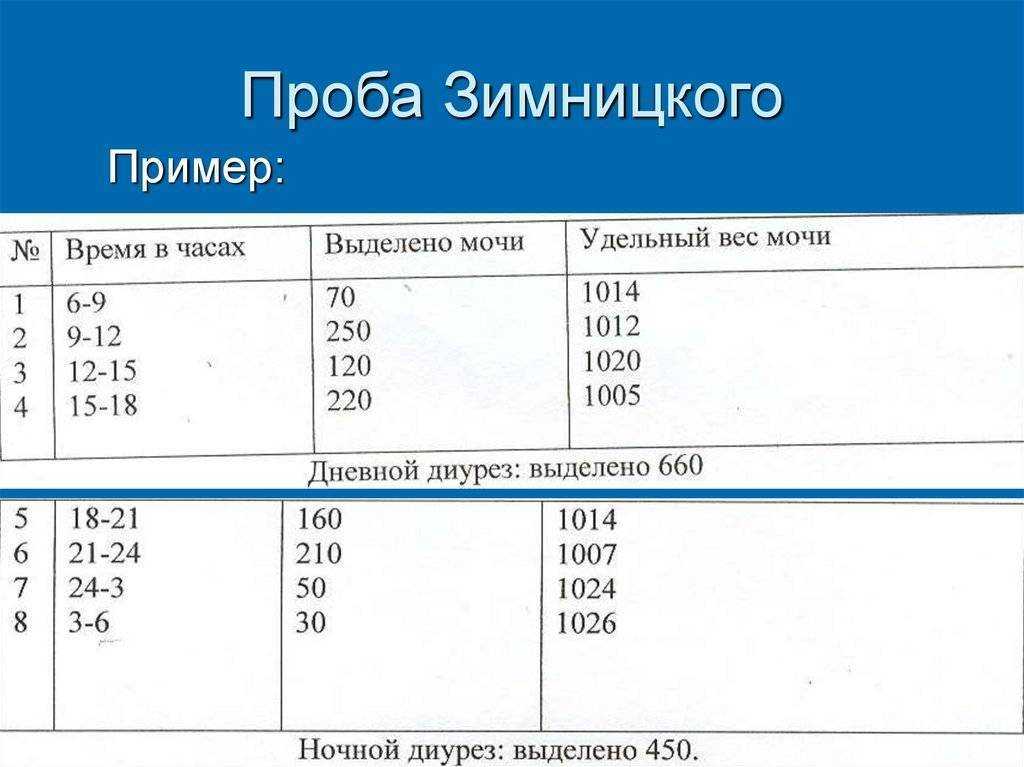 Анализ мочи по зимницкому