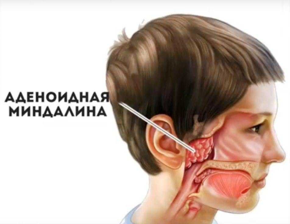 Скажите: «а»