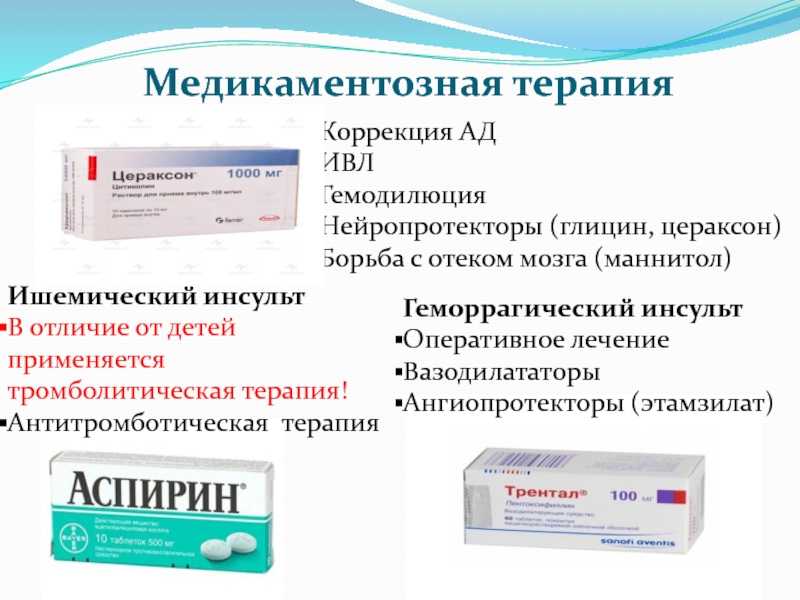 Инфаркт мозга