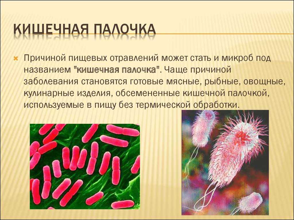 Эшерихия коли: что это  Кишечная палочка Escherichia coli  Кишечная палочка Escherichia coli – условно-патогенная бактерия палочкообразной формы,