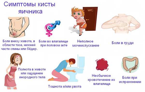 Киста яичника — диагностика, причины, симптомы у женщин, лечение кисты яичника