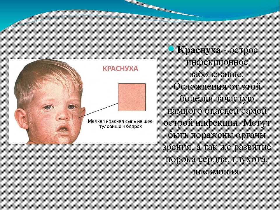 Краснуха: фото у детей, способы лечения - фото болезней