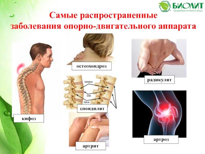 Заболевания опорно-двигательного аппарата. курсовая работа (т). медицина, физкультура, здравоохранение. 2015-07-07