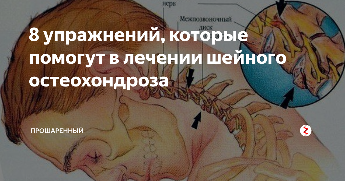 Хрустит шея при повороте головы: что делать, причины хруста, лечение