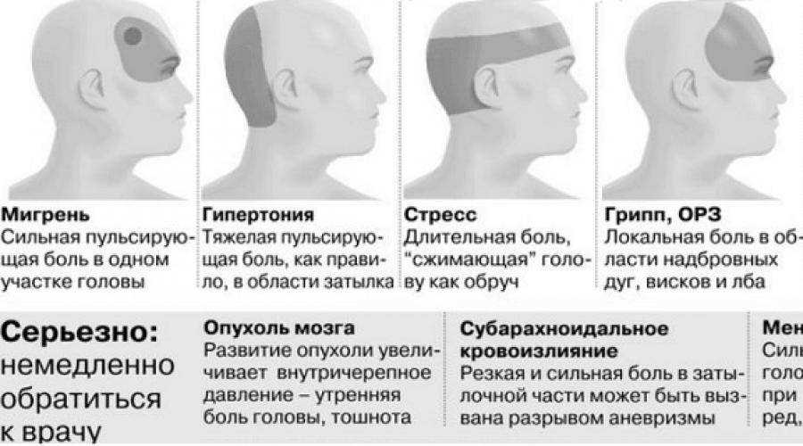 Болит голова после долгого сна утром - причины и лечение | во сне
