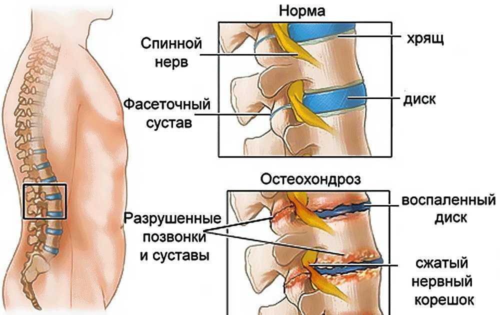 Болит спина, голова и шея: как возникает, причины, профилактика