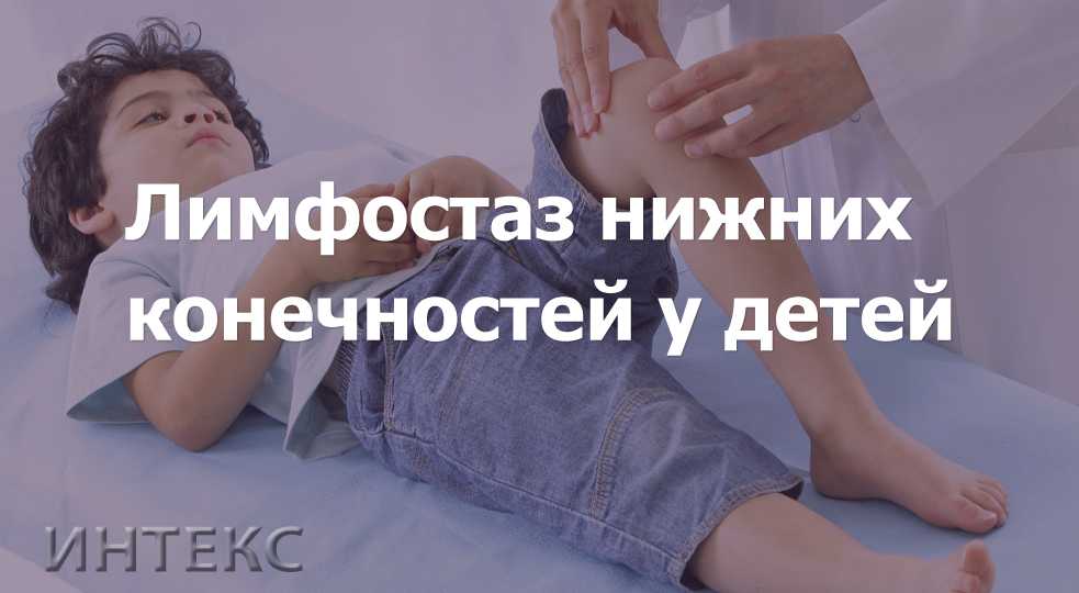Застой лимфы: упражнения для нормализации оттока