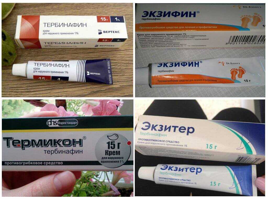 Опрелость в паху у мужчин: причины появления и методы лечения