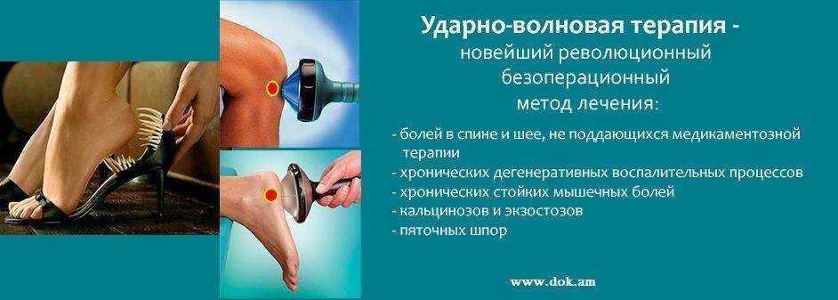 Ударно-волновая терапия