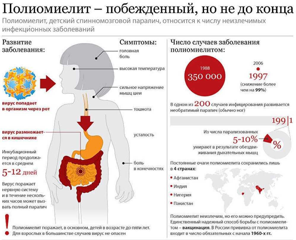 Полиомиелит у детей: симптомы, осложнения, статистика