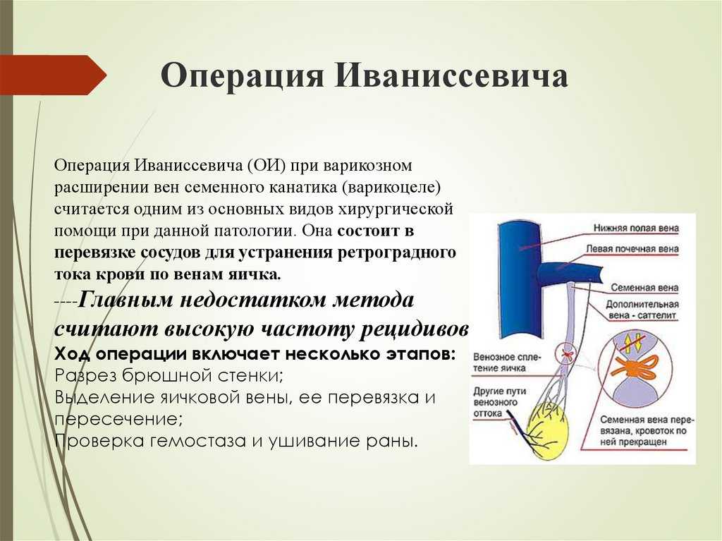 Операция мармара