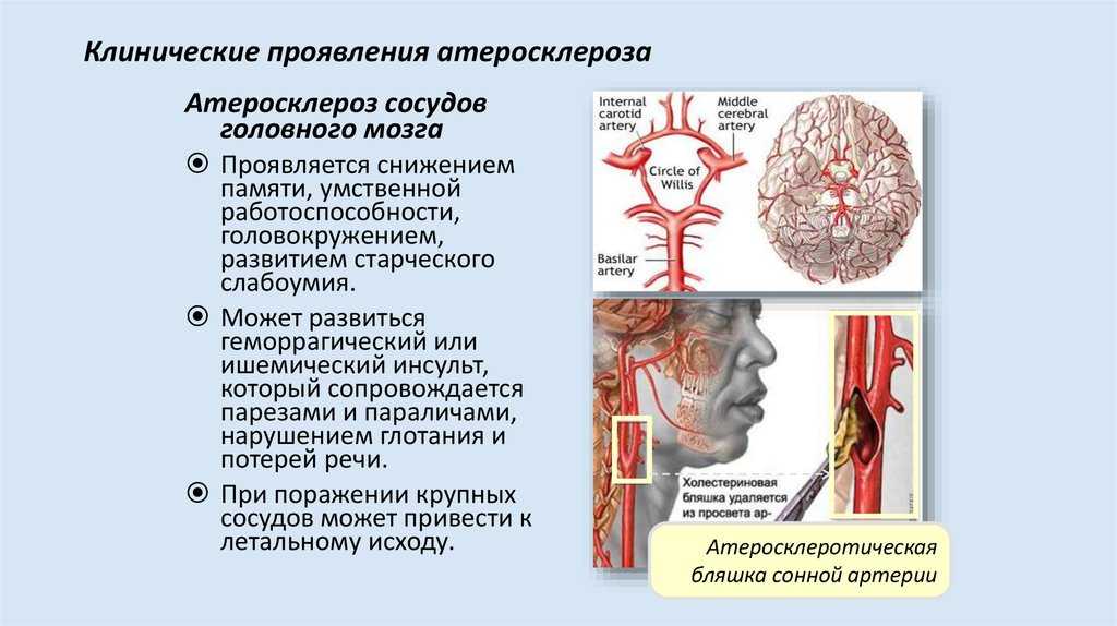 Узи сосудов головы и шеи (дуплексное и триплексное сканирование)