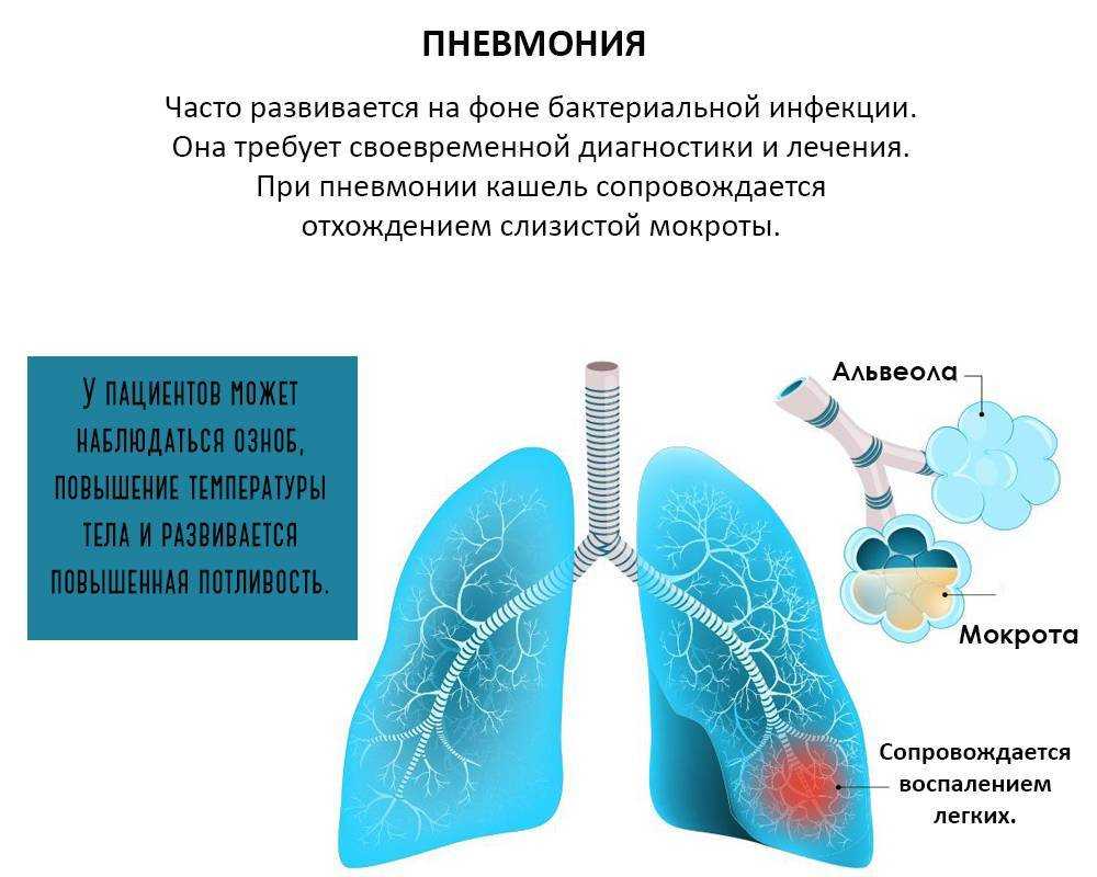 Как отличить бронхит от пневмонии по симптомам и результатам диагностических исследований