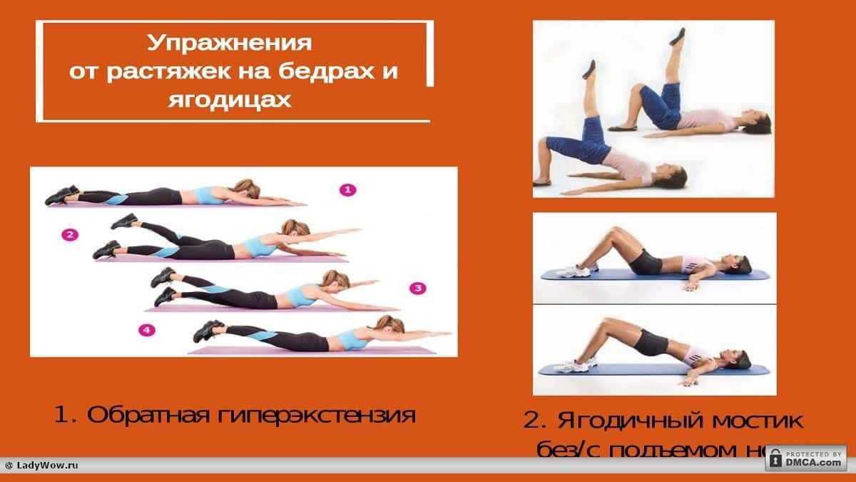 Как убрать растяжки? блог о здоровье и красоте