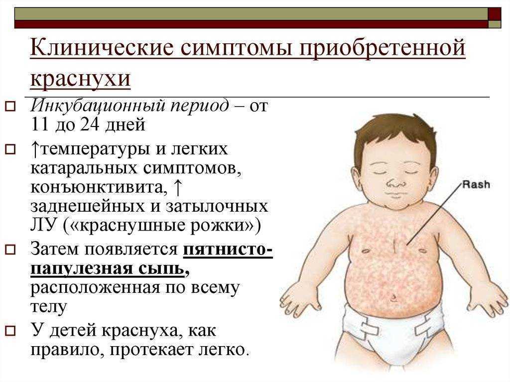 Детская розеола: фото и симптомы – лечение