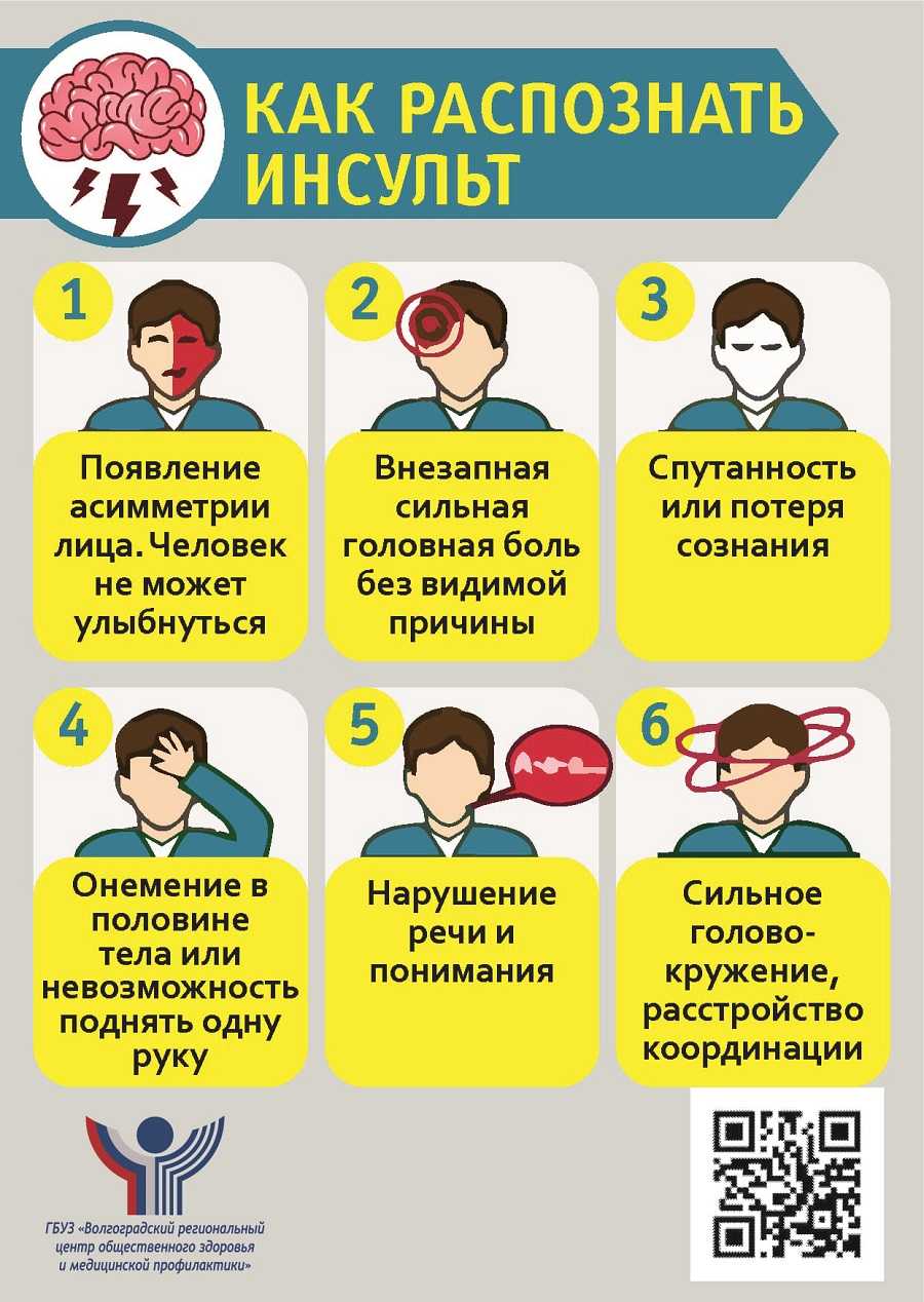 Инсульт - острое нарушение мозгового кровообращения