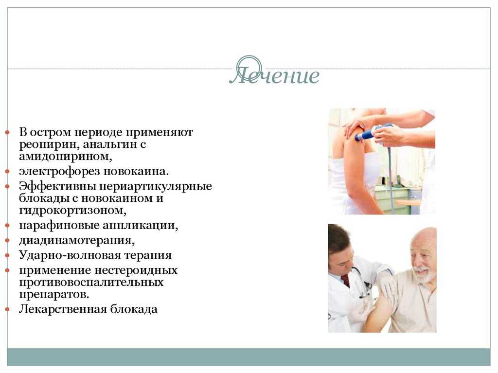 Электрофорез при остеохондрозе шейного отдела - описание и этапы проведения