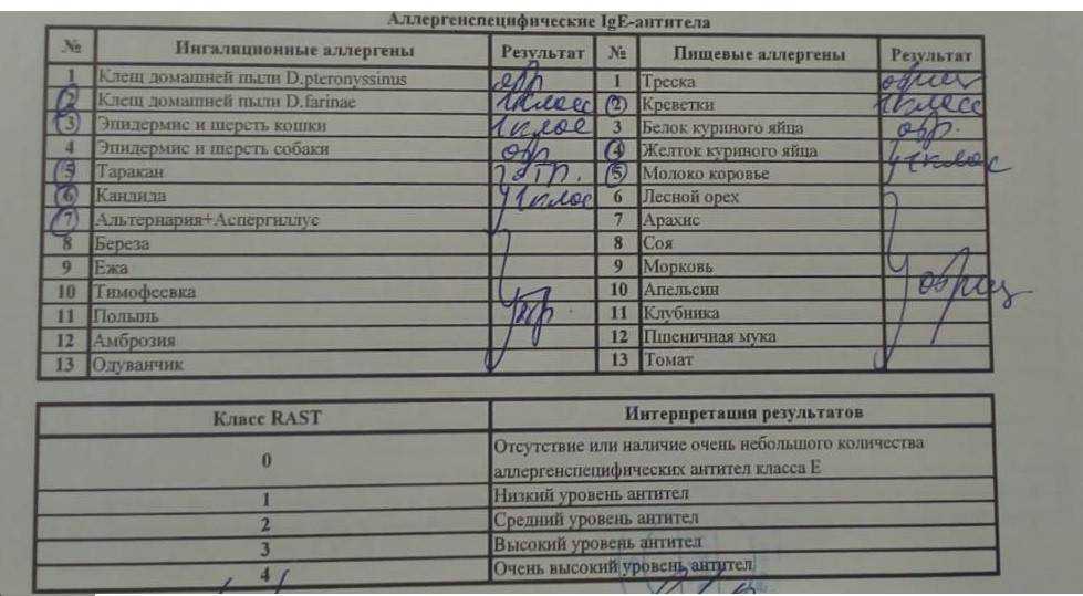 Анализ крови на аллергены: особенности, расшифровка