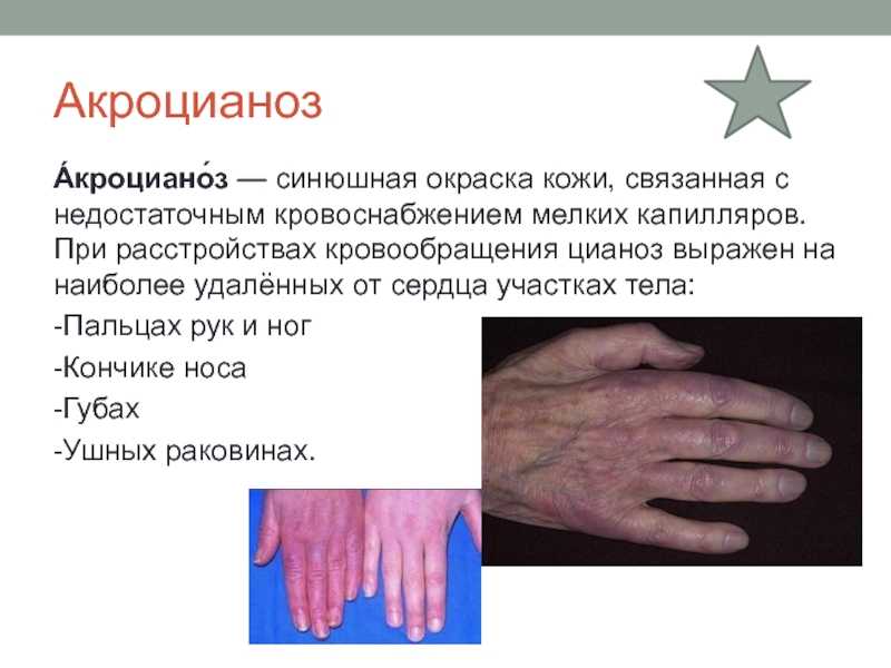 Бледность и цианотичность кожных покровов у ребенка