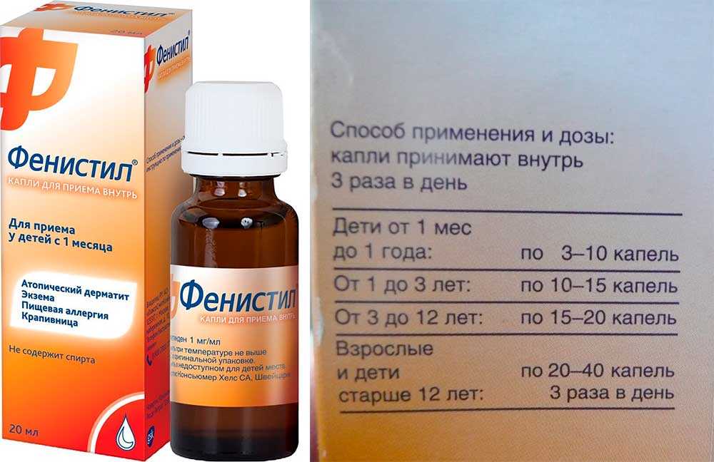 Аллергия после родов: как помочь себе и малышу?