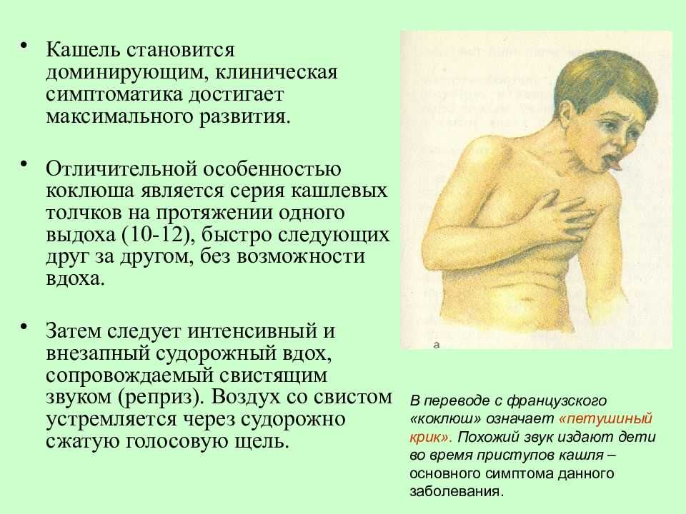 Как лечить кашель при коклюше у детей и взрослых?