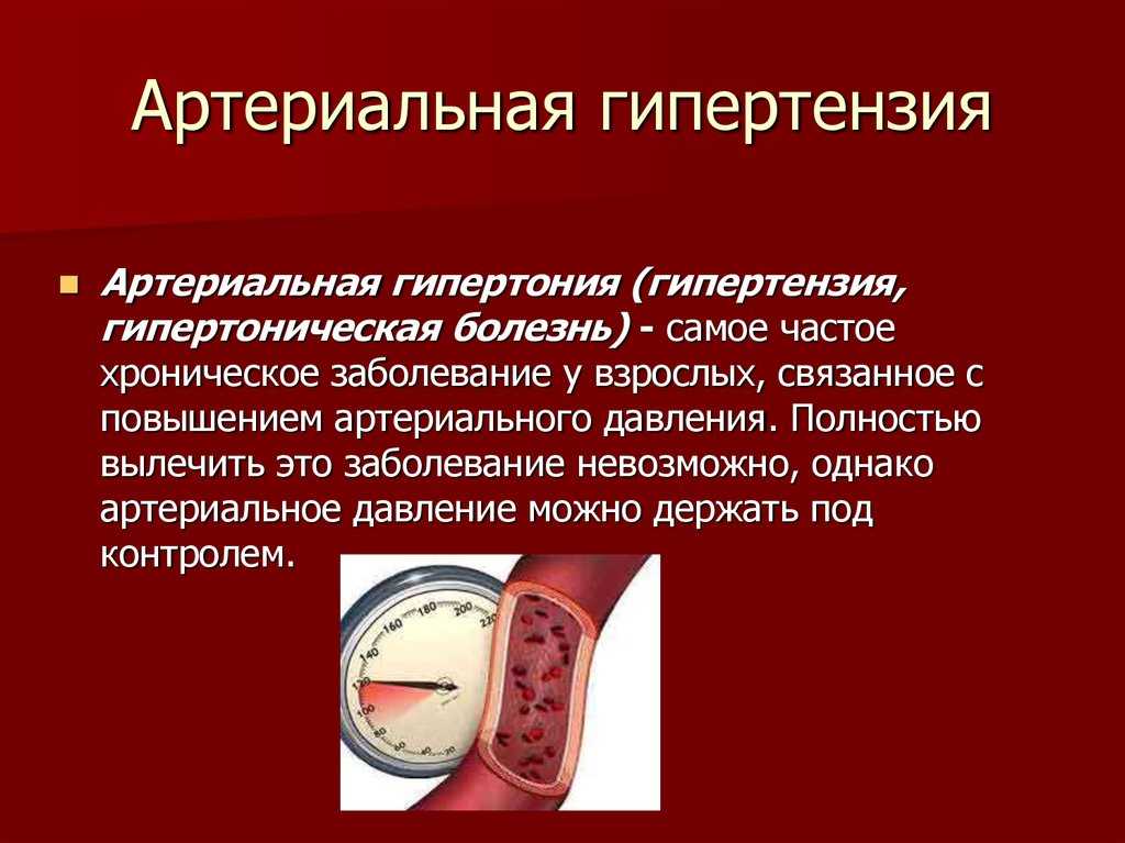 Гипертония: что это такое, классификация гипертонической болезни, симптомы и лечение гипертензии