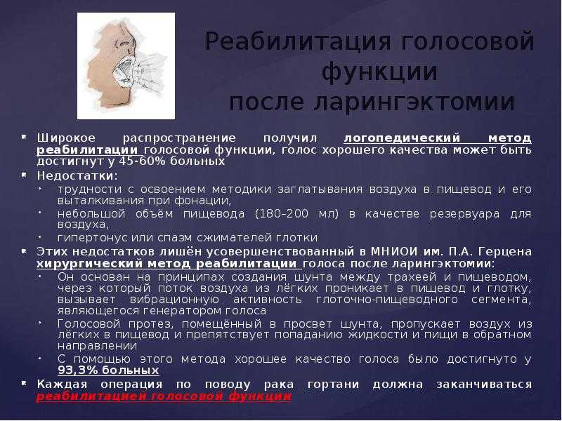 Ларингэктомия — большая медицинская энциклопедия