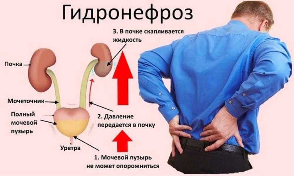 Как связаны почки и боль при дыхании?