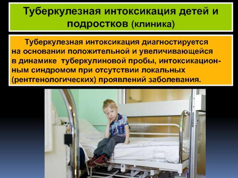 Туберкулезная интоксикация: симптомы, причины и лечение