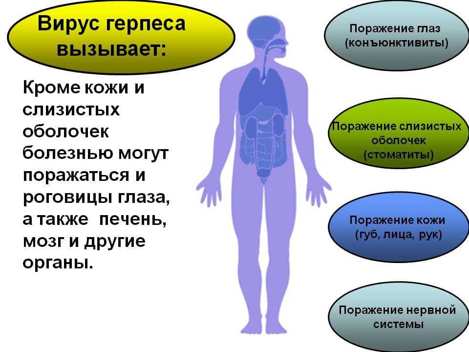 Герпес на соске | вирус герпес