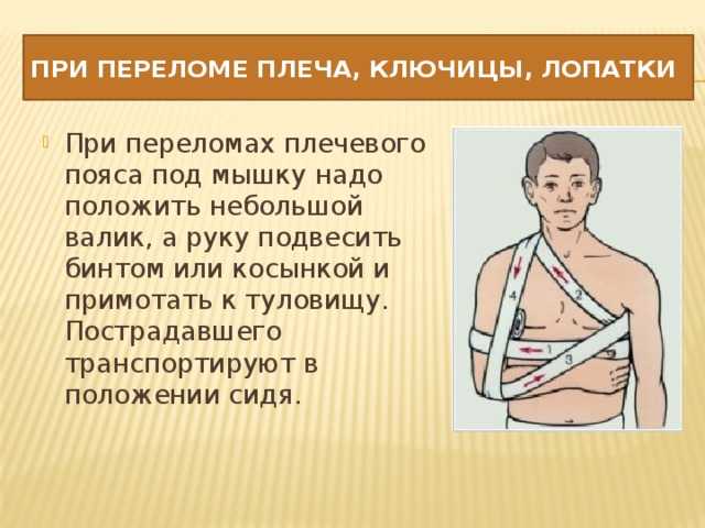 Ушиб плеча: симптомы, стадии, лечение, профилактика