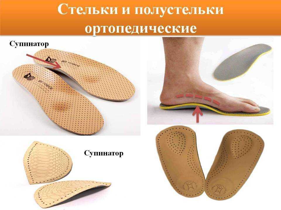 Ортопедические стельки при плоскостопии (продольном, поперечном): как выбрать, отзывы